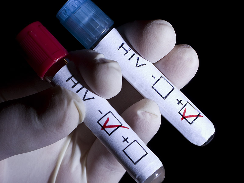 dt_140626_hiv_blood_vial_800x600